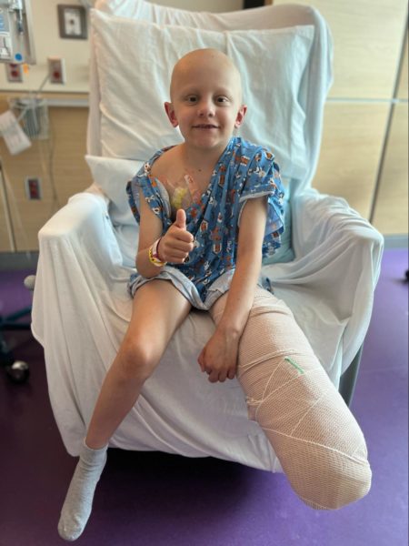child with one leg removed in a hospital bed giving a thumbs up